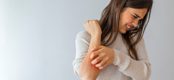 Psoríase precisa ser tratada para não se agravar