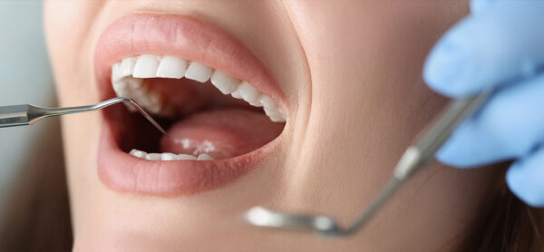 Uso incorreto de medicamentos e seus impactos na saúde bucal