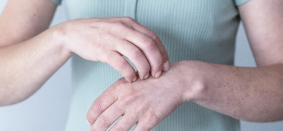 Pessoa observando manchas na pele do braço, sinal característico da hanseníase.